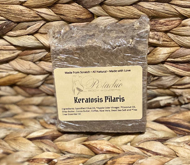 Keratosis Pilaris Soap Bar